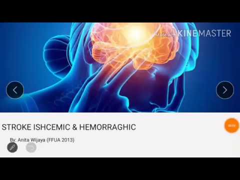 Mekanisme Stroke ischemic dan stroke Hemorrhaging (Etiologi, Patofisiologi)