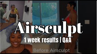 1-Week Airsculpt Update Results Q A