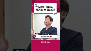 오래된 흉터도 치료가 가능한가요?