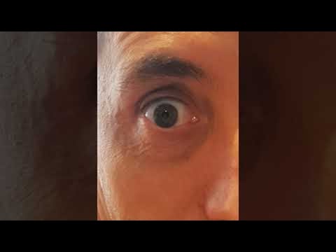 Loading video