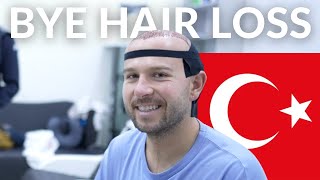 GETTING A HAIR TRANSPLANT IN TURKEY! | FULL STEP-BY-STEP PROCESS