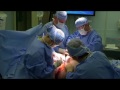 Dr. Joseph Michaels - World's Fattest Man as seen on TLC - Clip 2
