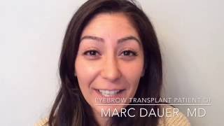 Amazing Eyebrow Transplant Testimonial