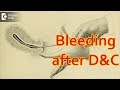 How many days do you bleed after a D&amp;C? - Dr. Sagar Bumb of Cloudnine Hospitals | Doctors&#39; Circle