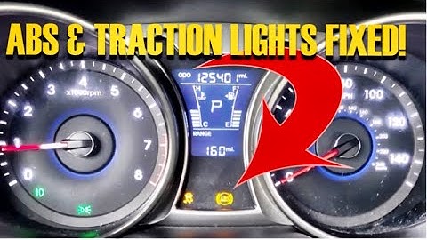 ABS & TRACTION LIGHT FIXED FAST & EASY ON A 2013 HYUNDAI VELOSTER, SONATA, ELANTRA, OPTIMA, FORTE