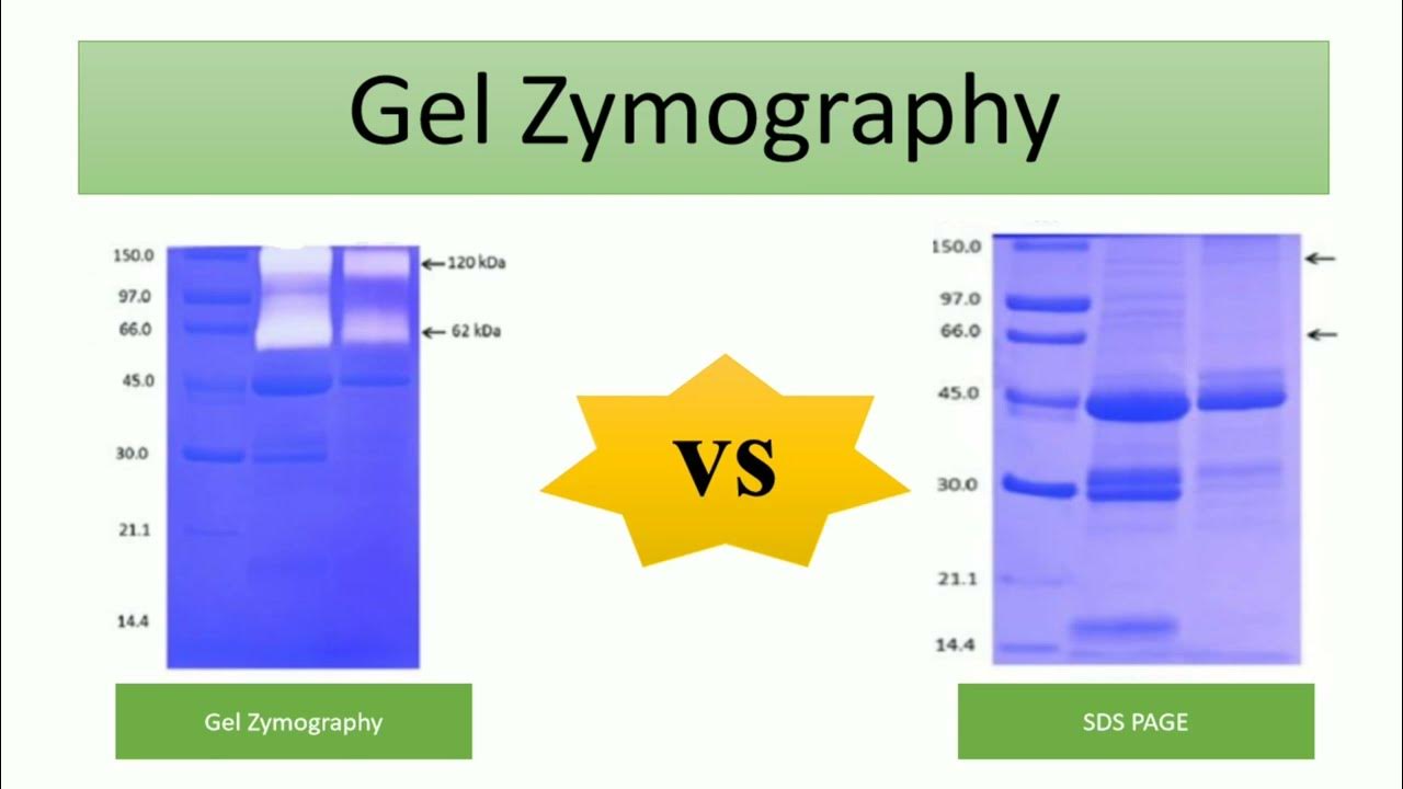 Gel zymography protein gel electrophoresis 5 YouTube