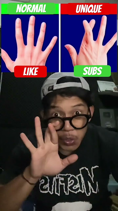 RARE HANDS 😱⁉️#marriagecentre