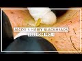 Jacob’s Hairy Blackheads (1st Session)
