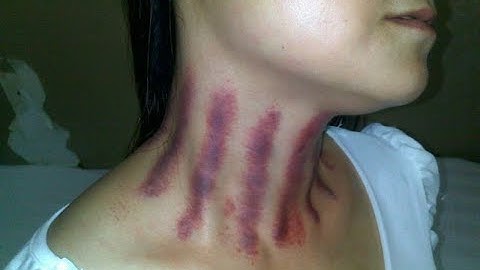 thuong cao gio, giựt gió trị cảm