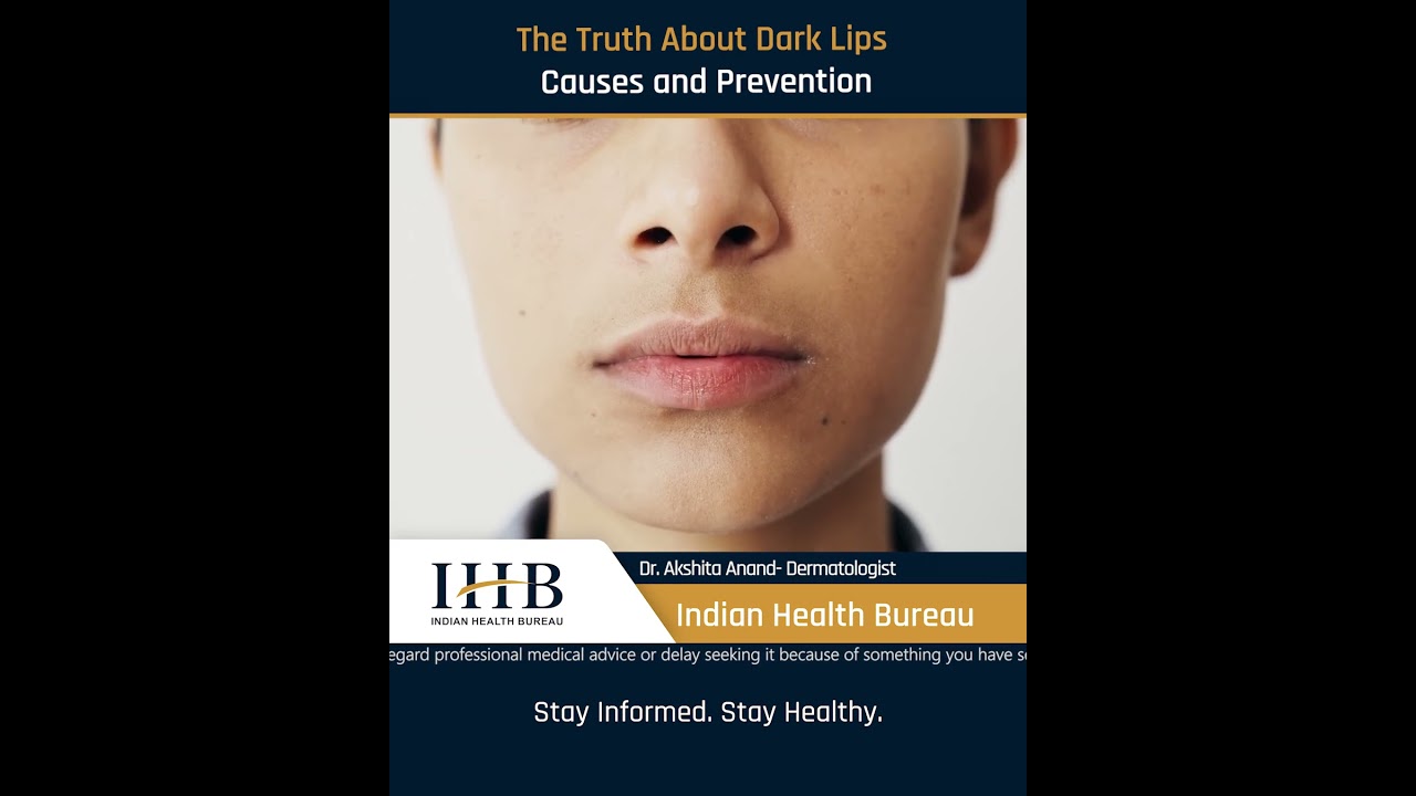 The Truth About Dark Lips Causes and Prevention_काले होंठों की सच्चाई, कारण और बचाव...