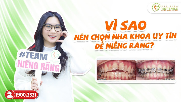 Niềng răng v line giá bao nhiêu năm 2024