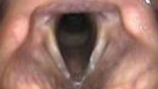 Anatomical Tutorial During Trans-Nasal Endoscopy screenshot 2