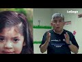 Operation Smile México transforma vidas: una sonrisa a la vez