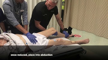 hip dislocation - flexion technique