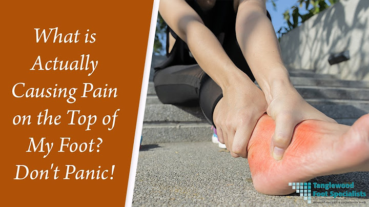 Pain below toes on top of foot