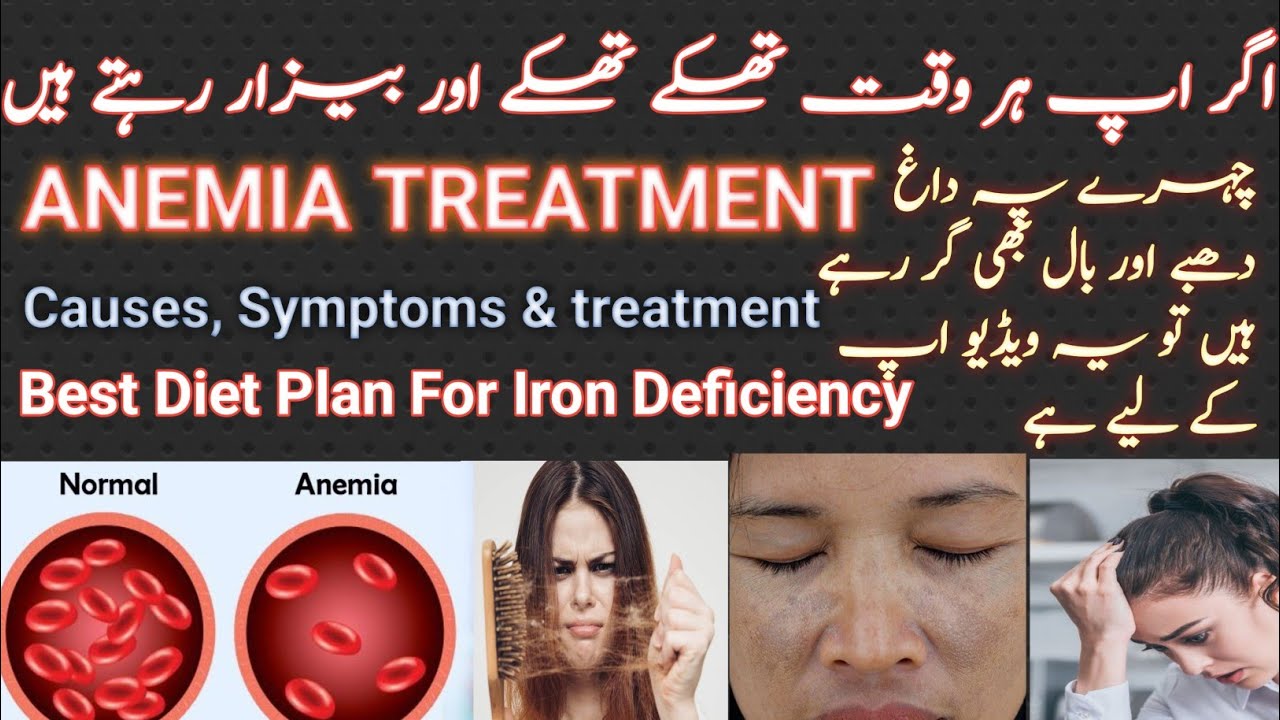 iron-deficiancy-anemia-symptoms-treatment-diet-plan-for-iron