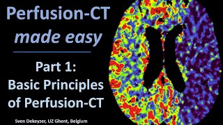 Perfusion CT made easy - part 1 - Principles of Perfusion CT