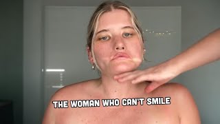 Meet The Woman Who Can't Smile 😐 | STORYTRENDER