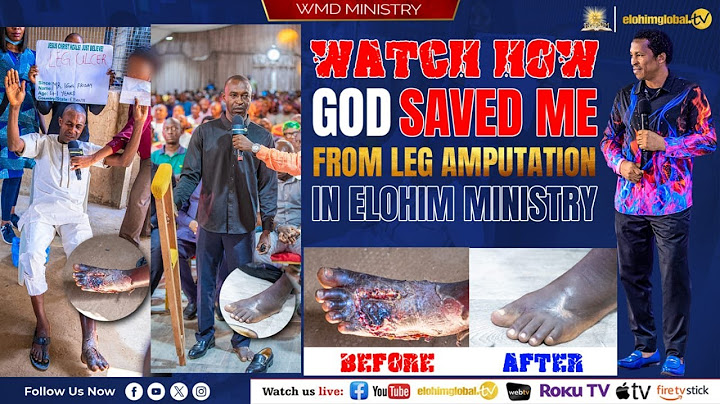 WATCH HOW GOD SAVED ME FROM LEG AMPUTATION IN ELOHIM MINISTRY