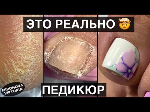 Video: Smalto gel per pedicure nel 2022: una foto del disegno sui piedi