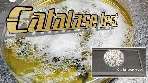 Catalase test - Biochemical microbiological test - How to perform on streptococcus species!