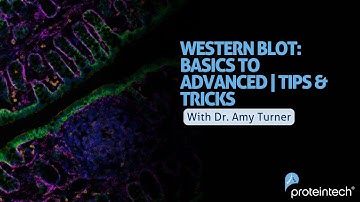 Western Blot: Basics to Advanced | Tips and Tricks