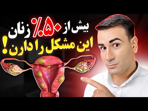 آیا فیبروم رحم خطرناک است درمان فیبروم رحم در خانه و راهنمای درمان سرپایی کم تهاجمی و حتی تهاجمی