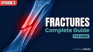 Fractures Explained Completely — Healing, Non-Union, Bone Grafting & ORIF | MBBS Orthopedics