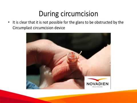 Post Circumcision Infant Care - Gentle Procedures Clinic - Toronto