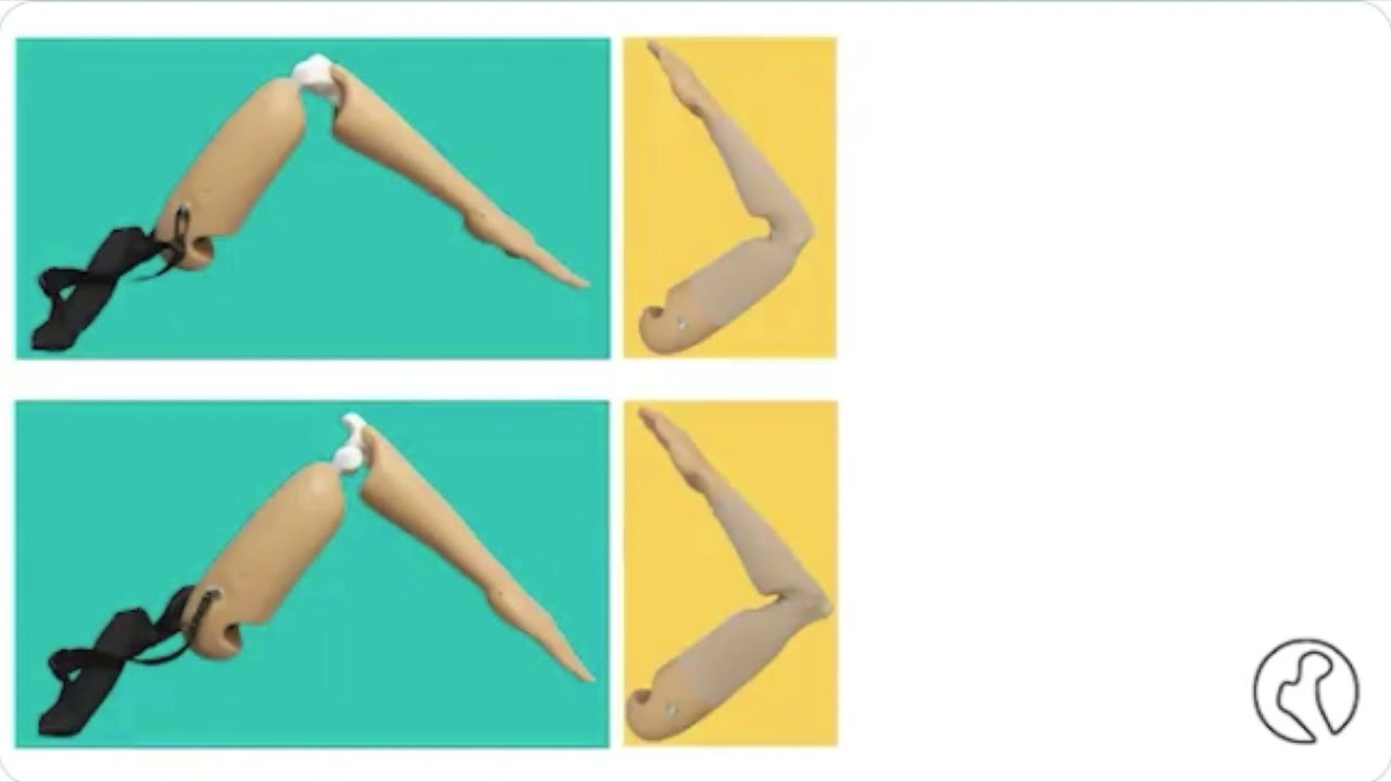 Elbow Dislocation Simulator official video | Medical Simulation | Athletic Training program |