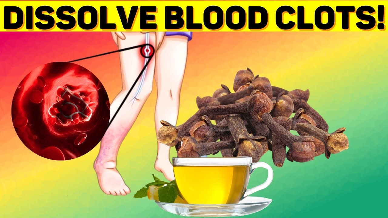 Best Foods to Dissolve Your Blood Clots (Clear Blood Clots Naturally