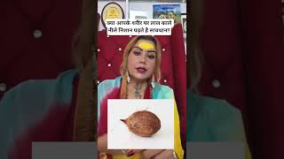 Download Lagu Do you get red, black and blue spots on your body? Be careful! MP3