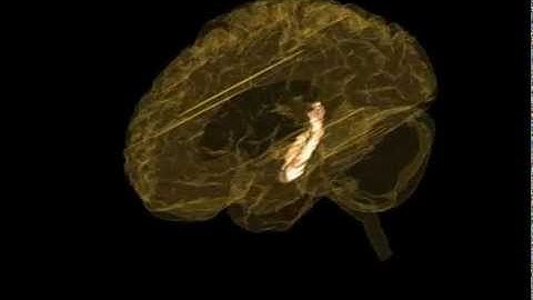3D Brain from MRI   7   Hippocampus