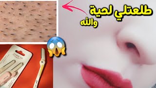 تجربتي الفاشلة مع شفرة الحلاقة لوجهي | ندمت * أتأذيت * !!