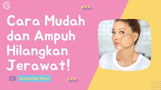 Jerawat Mendem / Batu Akibat Komedo? Ini Skincare & Cara Mengilangkan dari Dokter Kulit | Stylo.ID