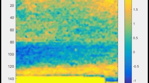 Ultrasound Visualization