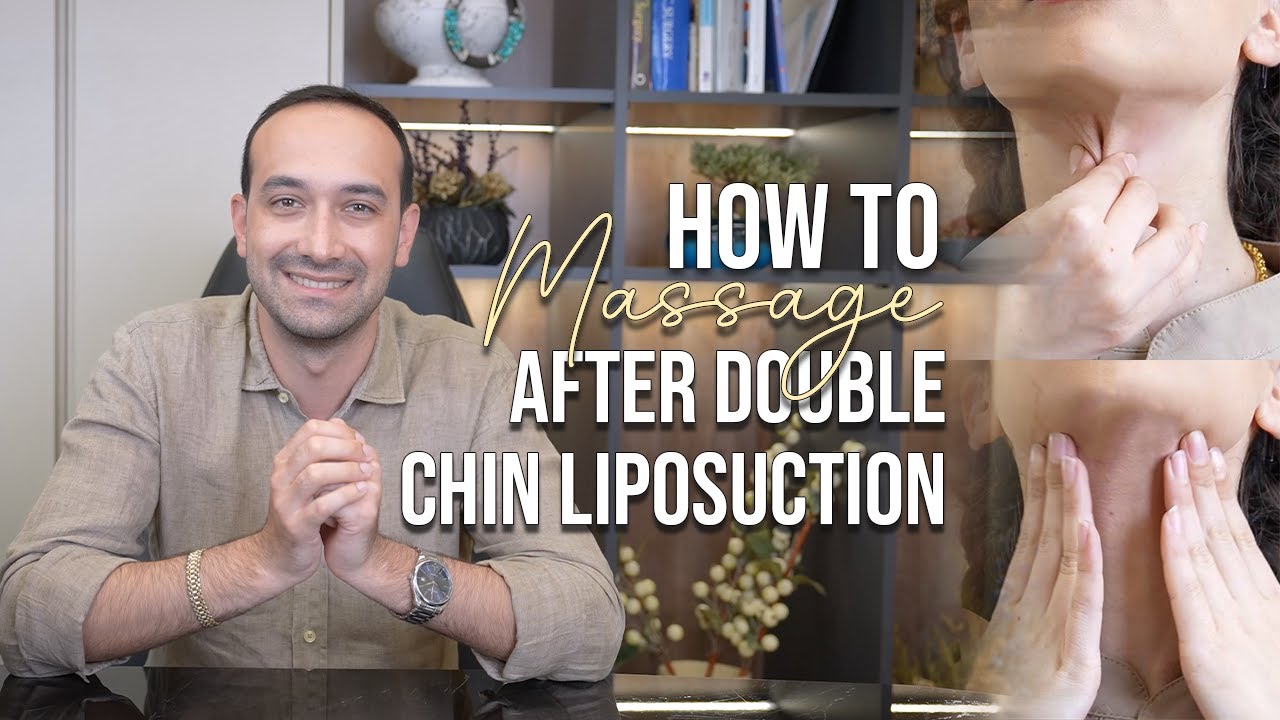 How to Massage After Double Chin Liposuction - YouTube