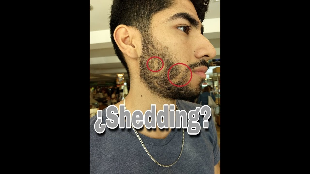 Que es Shedding?