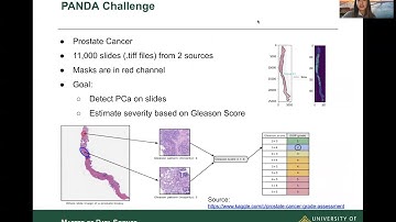 Multiple Instance Learning on Pathology Slides
