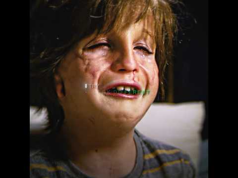 Wonder(2011)| 'The ugly boy has no friends Except Jack '#edit #movie