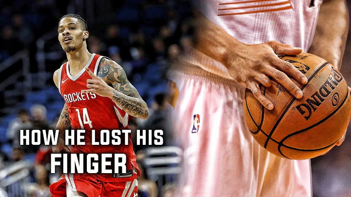 The Sad Story of How Gerald Green Lost His Finger