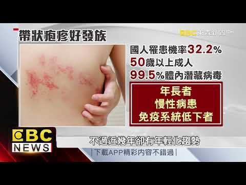 【聚焦真相】皮蛇難纏可致命 帶狀疱疹秋冬好發 林奕勳 曾于馨 採訪報導 @newsebc