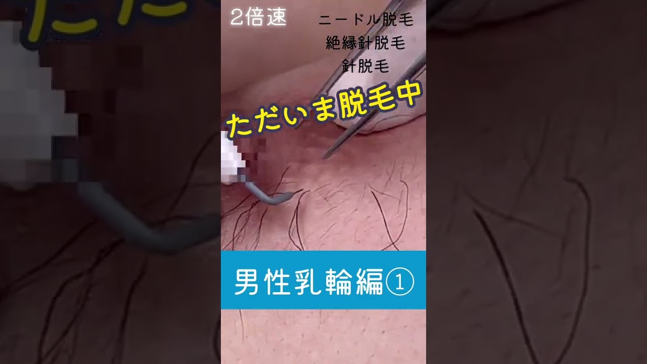 乳輪脱毛①#Shorts