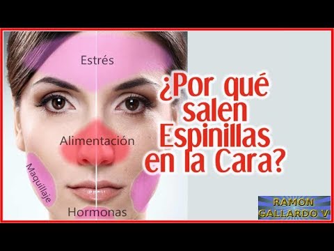 ACNE 👧👦 MUCHO MAS QUE ODIOSOS GRANITOS