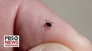 What you need to know to stay safe from ticks and Lyme disease this summer