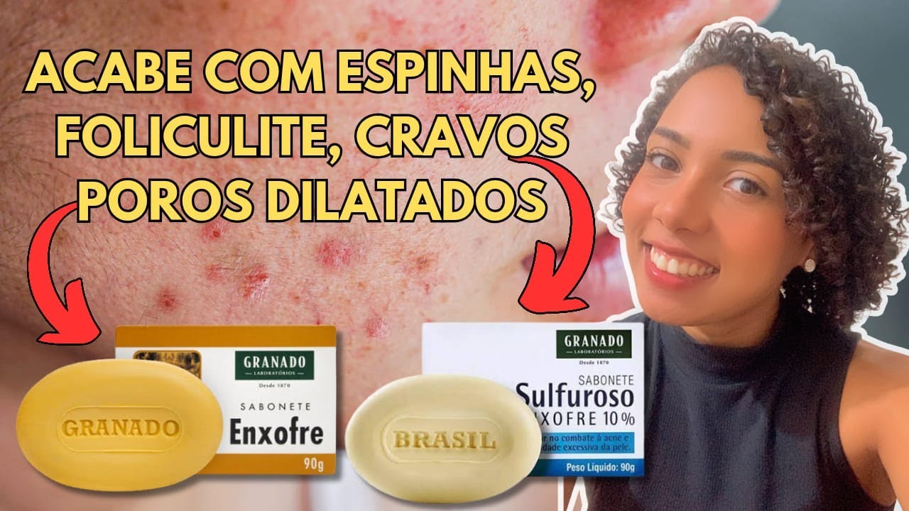 Como Usar SABONETE DE ENXOFRE para ter RESULTADO? - YouTube