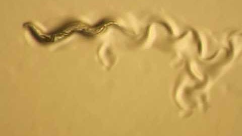 Rol-1 Mutant Phenotype C. elegans