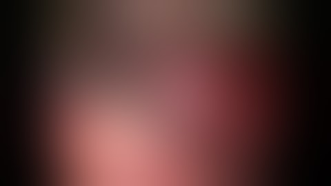 CHOLEDOCHAL CYST: LAPAROSCOPIC EXCISION AND ROUX EN Y HEPATICO-ENTEROSTOMY