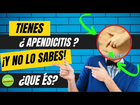 SÍNTOMAS sobre APENDICITIS