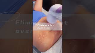 No More Ing In Lets Melt That Belly Fat Model Ls 78D2Maxsb